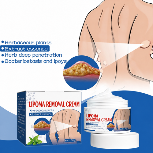 ⏰Last Day Promotion: 60% OFF🔥  Lipoma Removal Cream